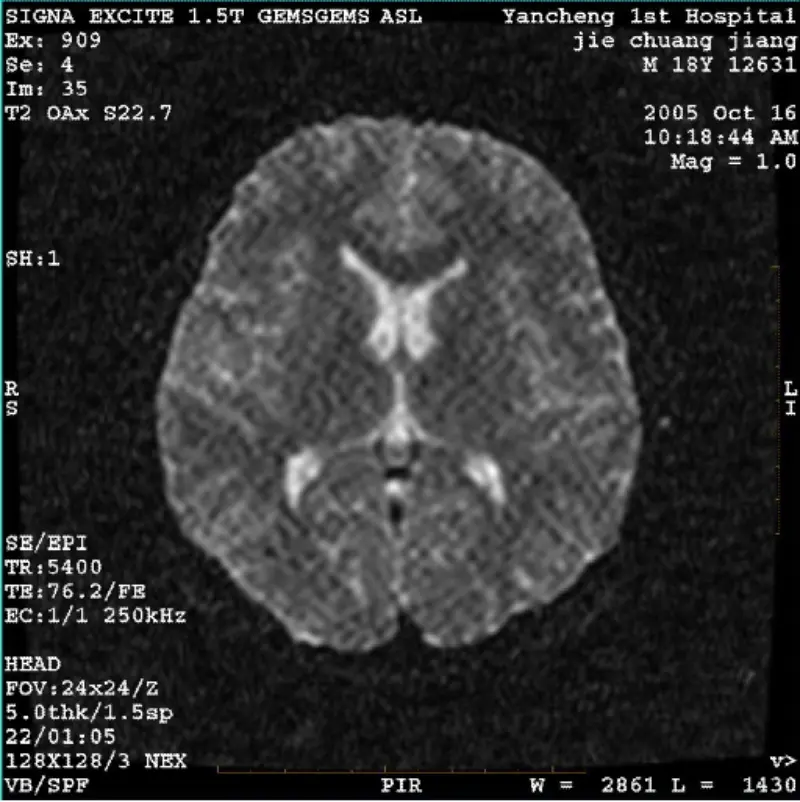 ARTIFACT WI/Fiesta Imagem Pixel Branco